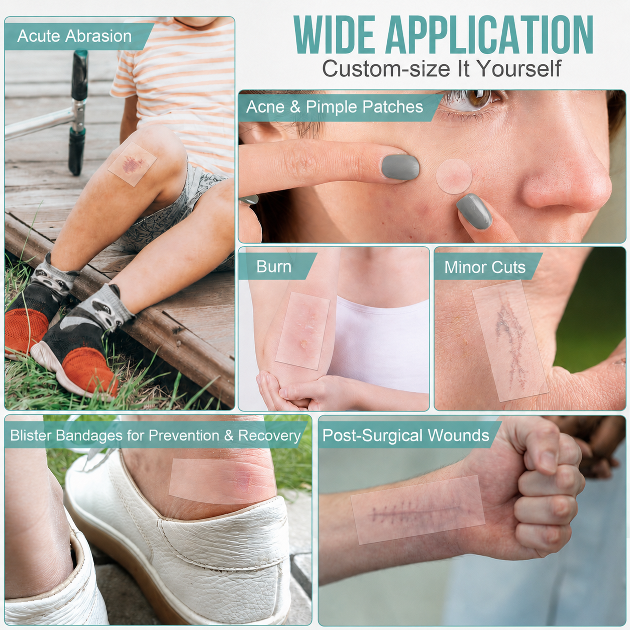 KHAZIX Hydrocolloid Bandage Ro - Skincare China ulasan dan harga