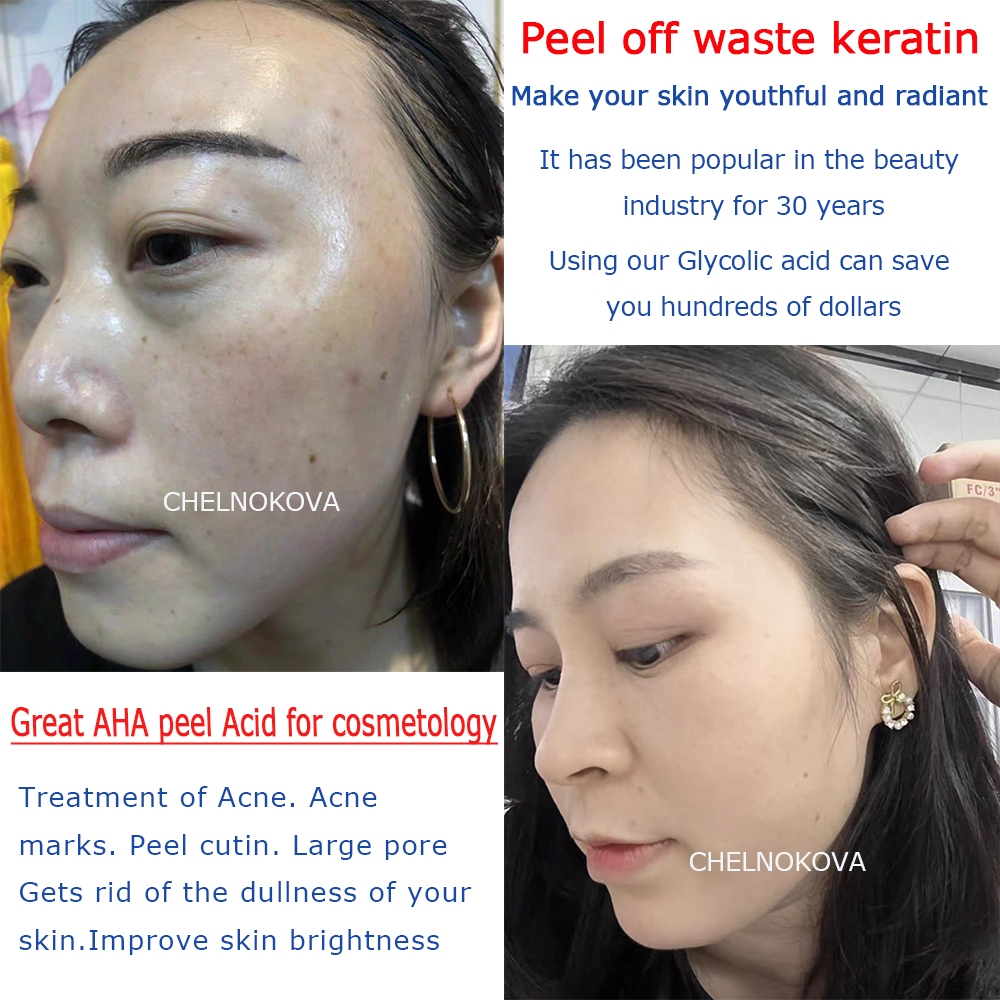 Citric acid 20% 30% 40% 50% pe - Skincare Whitening ulasan dan harga
