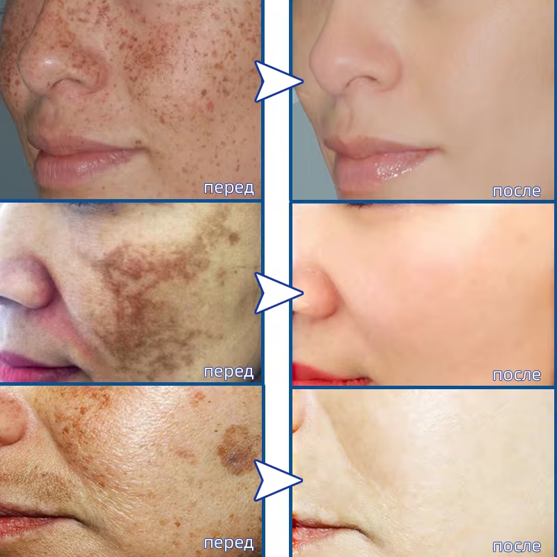 Powerful Spot-removing Whiteni - Skincare Vitamin C ulasan dan harga