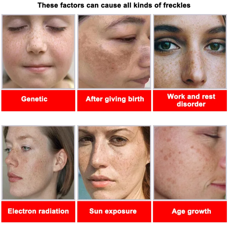 Powerful Spot-removing Whiteni - Skincare Vitamin C ulasan dan harga